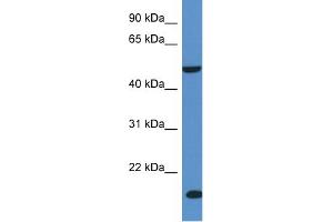 WB Suggested Anti-INPP5K Antibody Titration: 1. (INPP5K anticorps  (C-Term))