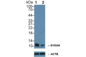 Rabbit Detection antibody from the kit in WB with Positive Control:  Sample Lane 1: Wild-type Hela cell lysate; Lane 2: S100A6 knockout Hela cell lysate;.
