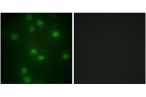 Immunofluorescence analysis of HuvEc cells, using Retinoblastoma (Phospho-Ser811) Antibody. (Retinoblastoma Protein (Rb) anticorps  (pSer811))