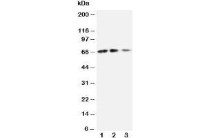 Western blot testing of CX3CL1 antibody and Lane 1:  recombinant mouse protein 10ng;  2: 5ng;  3: 2. (CX3CL1 anticorps  (N-Term))
