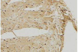 ABIN6274722 at 1/100 staining Mouse muscle tissue by IHC-P. (MRPS7 anticorps)