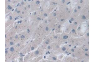 Detection of STIP1 in Human Liver Tissue using Polyclonal Antibody to Stress Induced Phosphoprotein 1 (STIP1)