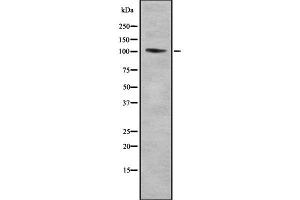 Western blot analysis of TTF1 using HepG2 whole cell lysates (TTF1 anticorps  (Internal Region))