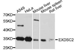Western blot analysis of extracts of various cell lines, using EXOSC2 antibody. (EXOSC2 anticorps  (AA 1-293))