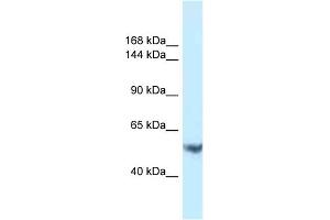 Host: Rabbit Target Name: EPHA1 Sample Type: PANC1 Whole Cell lysates Antibody Dilution: 1.