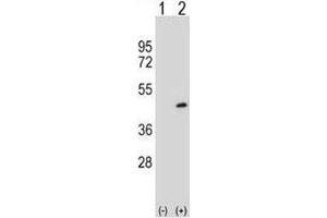 Western blot analysis of PRMT6 antibody and 293 cell lysate either nontransfected (Lane 1) or transiently transfected (2) with the PRMT6 gene.