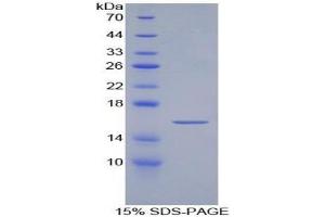 SDS-PAGE analysis of Artemin Protein. (ARTN Protéine)