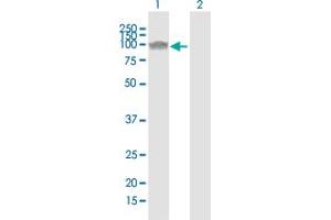 Western Blot analysis of NLGN1 expression in transfected 293T cell line by NLGN1 polyclonal antibody (A01).