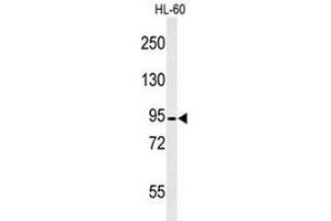 Western blot analysis of CAPN3 Antibody (C-term) in HL-60 cell line lysates (35µg/lane). (Calpain 3 anticorps  (C-Term))