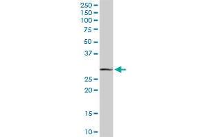 MAGEA9 MaxPab rabbit polyclonal antibody.