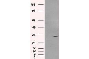 Image no. 4 for anti-Fc Fragment of IgG, Low Affinity IIa, Receptor (CD32) (FCGR2A) antibody (ABIN1497264)