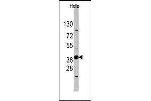 Image no. 1 for anti-Ectodysplasin A (EDA) (N-Term) antibody (ABIN358789)
