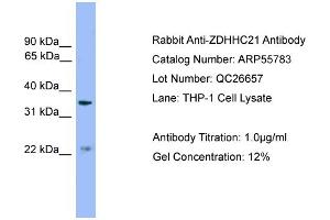 WB Suggested Anti-ZDHHC21  Antibody Titration: 0. (ZDHHC21 anticorps  (Middle Region))