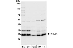 anti-Ribosomal Protein L27 (RPL27) (AA 50-100) antibody
