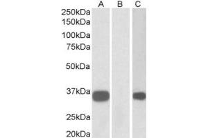 Western Blotting (WB) image for anti-Abhydrolase Domain Containing 14B (ABHD14B) (Internal Region) antibody (ABIN2465095) (ABHD14B anticorps  (Internal Region))