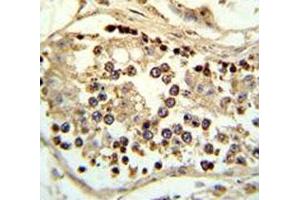 IHC analysis of FFPE human testis tissue stained with ABHD12 antibody (ABHD12 anticorps  (AA 40-66))