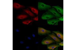 ABIN7093965 and ABIN7098009 staining  cells by IF/ICC. (PSPH anticorps  (Internal Region))