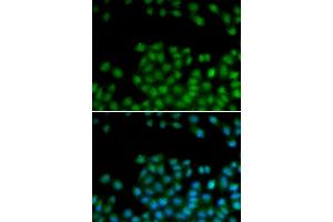 Immunofluorescence analysis of HeLa cells using SFRP2 antibody (ABIN5973117). (SFRP2 anticorps)