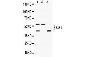 Western blot analysis of E2F4 expression in HELA whole cell lysates ( Lane 1), U20S whole cell lysates ( Lane 2) and MCF-7 whole cell lysates ( Lane 3). (E2F4 anticorps  (N-Term))