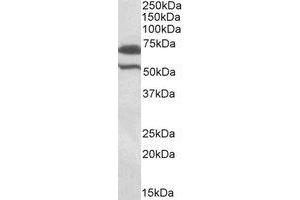Western Blotting (WB) image for anti-Baculoviral IAP Repeat Containing 3 (BIRC3) (Internal Region) antibody (ABIN2464738) (BIRC3 anticorps  (Internal Region))