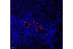 Immunofluorescence of paraffin embedded rat spleen using CNG1 (ABIN7073608) at dilution of 1:700 (400x lens)