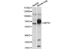 Western blot analysis of extracts of various cell lines, using SEPN1 antibody (ABIN6289941) at 1:1000 dilution. (Selenoprotein N anticorps)