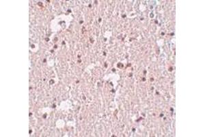 anti-FERM and PDZ Domain Containing 3 (FRMPD3) (Center) antibody