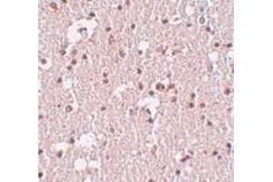 Immunohistochemistry of FRMPD3 in human brain tissue with FRMPD3 antibody at 5 μg/ml. (FRMPD3 anticorps  (Center))