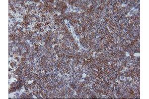 Immunohistochemistry (IHC) image for anti-T-cell surface glycoprotein CD1c (CD1C) antibody (ABIN1497187) (CD1c anticorps)