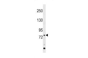 Western blot analysis in WiDr cell line lysates (35ug/lane). (GPR149 anticorps  (AA 421-449))