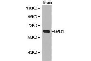 Western Blotting (WB) image for anti-Glutamate Decarboxylase 1 (Brain, 67kDa) (GAD1) antibody (ABIN1872765) (GAD anticorps)