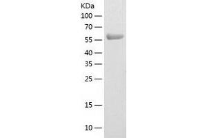 Western Blotting (WB) image for Wolf-Hirschhorn Syndrome Candidate 2 (WHSC2) (AA 1-539) protein (His-IF2DI Tag) (ABIN7125741)