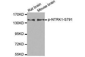 Western blot analysis of extracts from rat and mouse brain tissue using Phospho-NTRK1-S791 antibody (ABIN2987788). (TRKA anticorps  (pSer791))