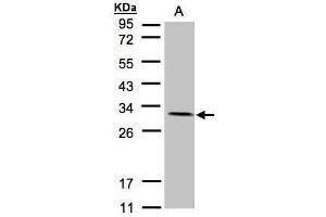 WB Image Sample(30 μg of whole cell lysate) A:A431, 12% SDS PAGE antibody diluted at 1:1500