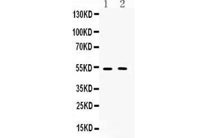 Western blot analysis of CHRM2 expression in rat brain extract ( Lane 1) and mouse brain extract ( Lane 2). (Muscarinic Acetylcholine Receptor M2 anticorps  (C-Term))