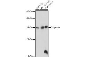 Western blot analysis of extracts of various cell lines, using Calponin antibody (ABIN7266040) at 1:1000 dilution. (CNN1 anticorps  (AA 130-180))