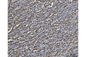 IHC analysis of ARL13B using anti-ARL13B antibody (ABIN7600179).