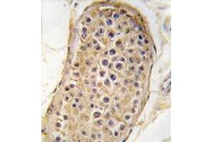 Formalin-fixed and paraffin-embedded human testis tissue reacted with RICTOR antibody (N-term) , which was peroxidase-conjugated to the secondary antibody, followed by DAB staining. (RICTOR anticorps  (N-Term))