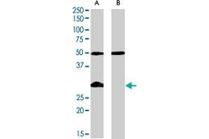 IGFBP3 polyclonal antibody  (0. (IGFBP3 anticorps)