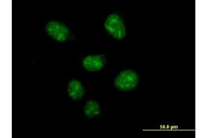 Immunofluorescence of purified MaxPab antibody to USF2 on HeLa cell.