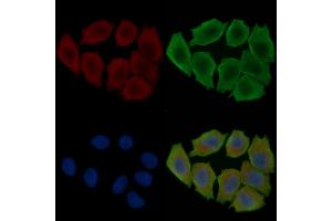 ABIN6263901 and ABIN6278065 staining Hela cells(30 min of UV treatment) by IF/ICC. (ORAI1 anticorps  (C-Term))