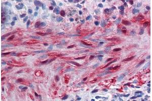 Human Colon, muscularis mucosa: Formalin-Fixed, Paraffin-Embedded (FFPE) (YAP1 anticorps  (AA 53-162))