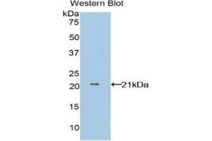 Western Blotting (WB) image for anti-Non-Metastatic Cells 1, Protein (NM23A) Expressed in (NME1) (AA 1-152) antibody (ABIN3202548) (NME1 anticorps  (AA 1-152))