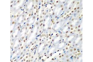 Immunohistochemistry of paraffin-embedded Mouse kidney using SF3B3 Polyclonal Antibody at dilution of 1:200 (40x lens). (SF3B3 anticorps)