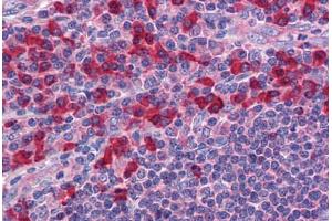 Human Tonsil: Formalin-Fixed, Paraffin-Embedded (FFPE)