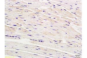 Formalin-fixed and paraffin embedded rat myocardium tissue labeled with Anti-Connexin-40 Polyclonal Antibody, Unconjugated  at 1:200, followed by conjugation to the secondary antibody and DAB staining (Cx40/GJA5 anticorps  (AA 301-358))