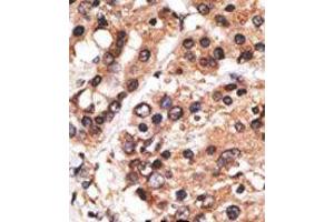 Image no. 2 for anti-Protein AF-9 (MLLT3) (C-Term) antibody (ABIN358673) (AF9 anticorps  (C-Term))