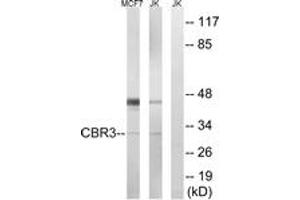 Western blot analysis of extracts from Jurkat/MCF7 cells, using CBR3 Antibody. (CBR3 anticorps  (AA 151-200))