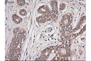 Immunohistochemistry (IHC) image for anti-Carboxypeptidase A1 (Pancreatic) (CPA1) (AA 1-419) antibody (ABIN1490771) (CPA1 anticorps  (AA 1-419))