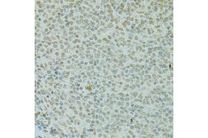 Immunohistochemistry of paraffin-embedded rat spleen using RCC1 antibody. (RCC1 anticorps  (AA 1-240))
